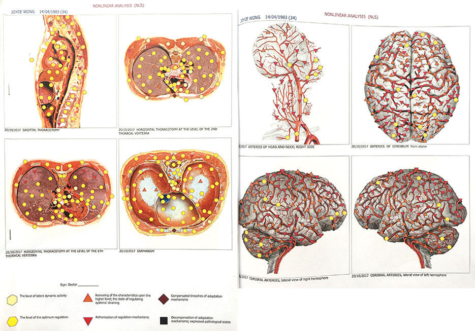 v-wellness-centre-kuala-lumpur-malaysia-16-bio-resonance-scan