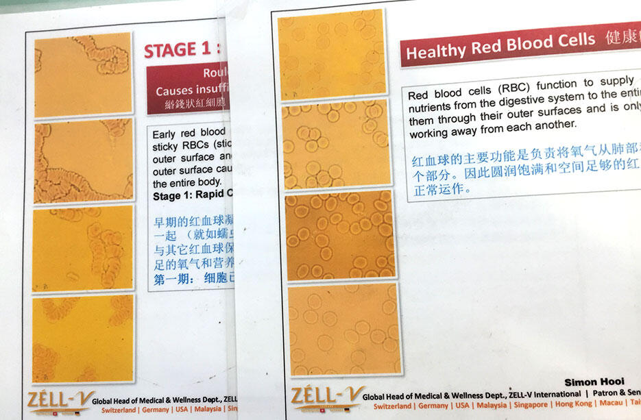 Live Blood Analysis Chart